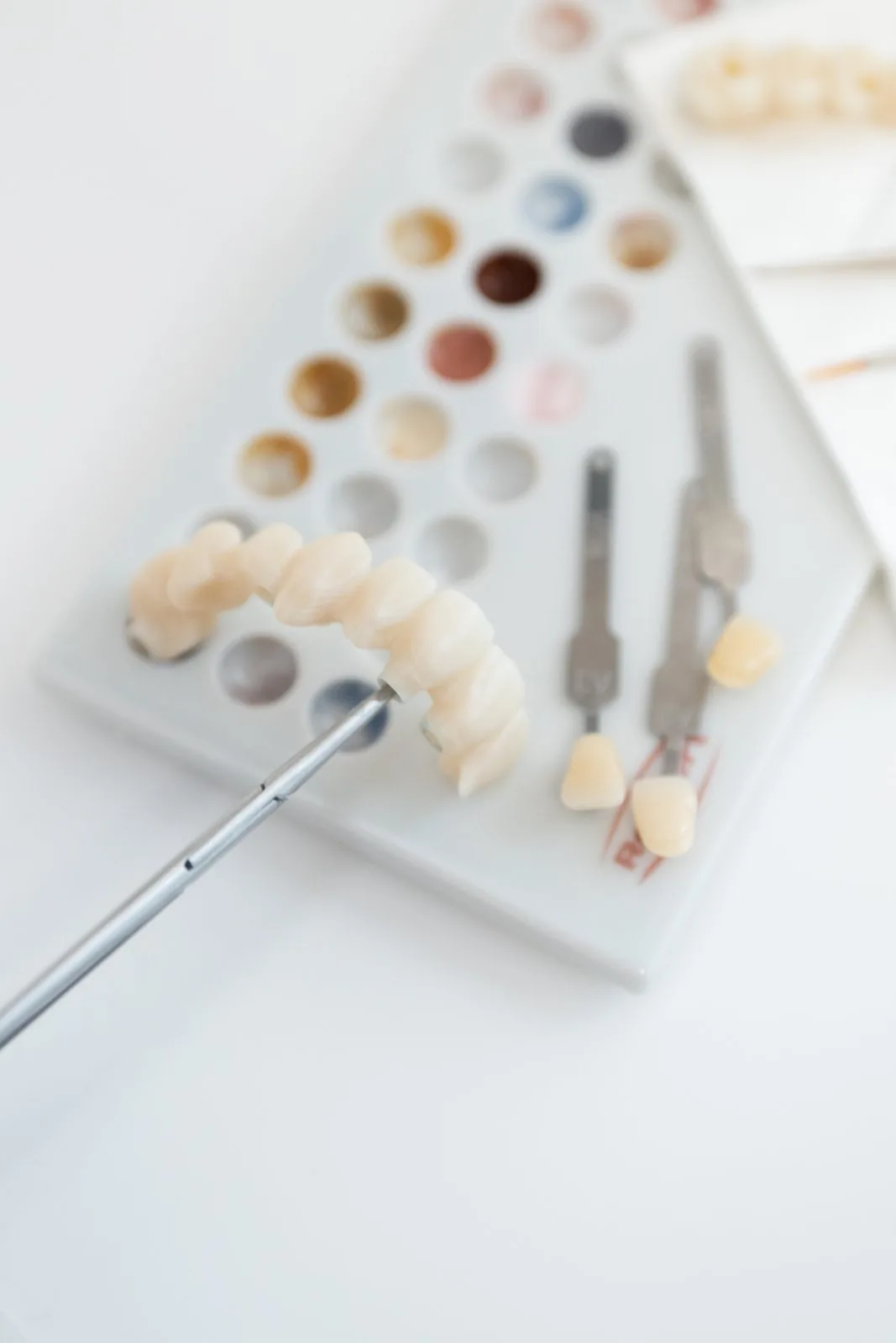 Keramikimplantate in Weißenfels – die natürliche Wahl